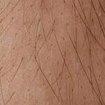 Detailed macro image showing human skin texture and hair follicles.