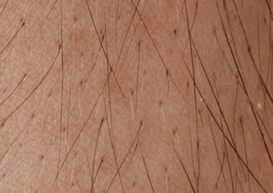 Detailed macro image showing human skin texture and hair follicles.
