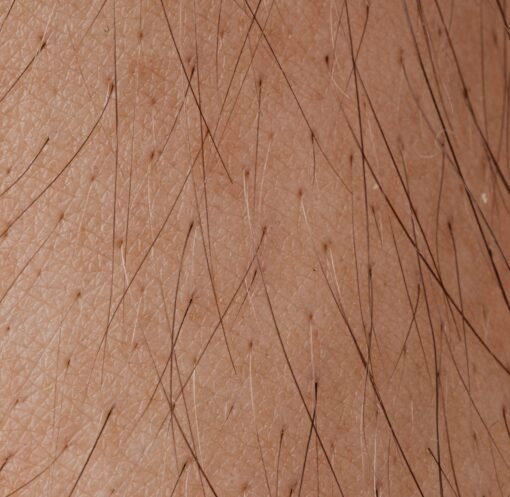 Detailed macro image showing human skin texture and hair follicles.