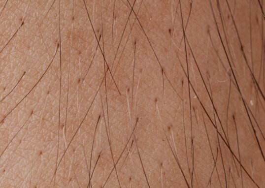 Detailed macro image showing human skin texture and hair follicles.