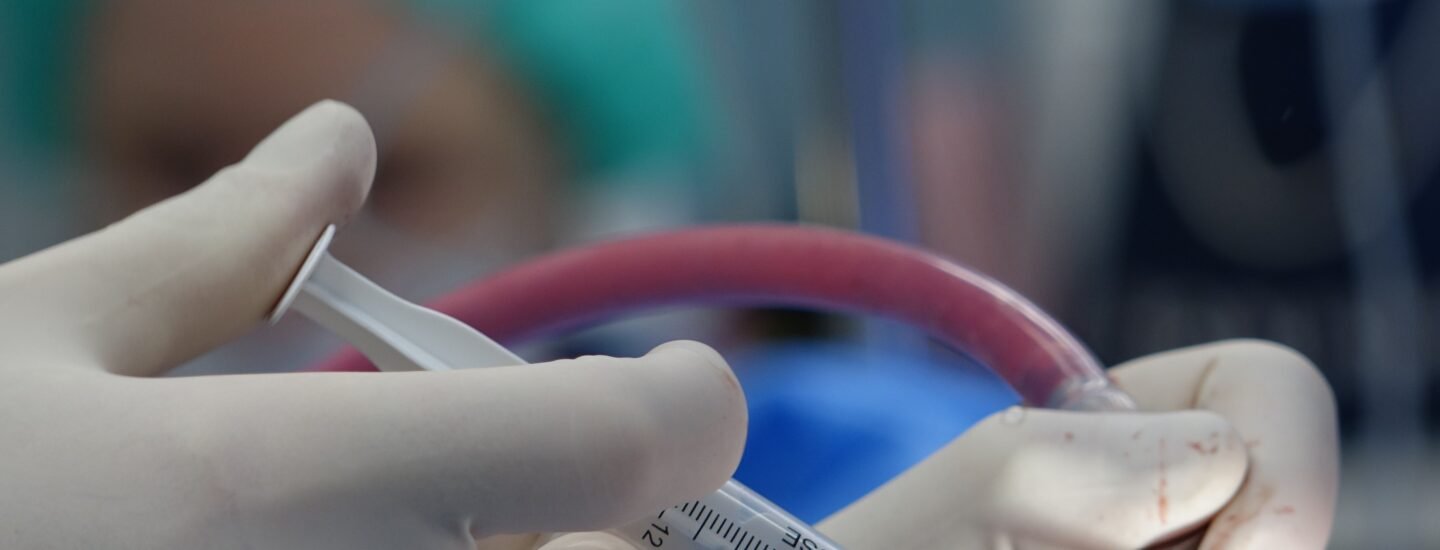 Surgeon's hands handling syringe during a medical procedure in a sterile operating room.